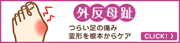 外反母趾